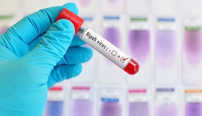 Nipah Virus: केंद्र ने लैब यूनिट के साथ एक टीम केरल भेजी