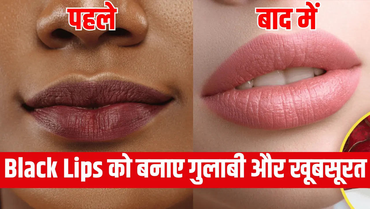 Black Lips : काले होठों को गुलाबी बनाने के लिए उपयोग करें ये घरेलू नुस्खे